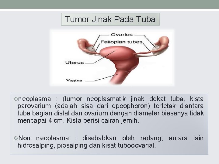 Tumor Jinak Pada Tuba vneoplasma : (tumor neoplasmatik jinak dekat tuba, kista parovarium (adalah
