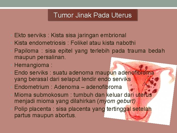 Tumor Jinak Pada Uterus • Ekto serviks : Kista sisa jaringan embrional • Kista