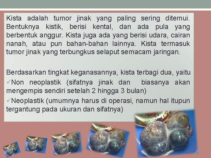 Kista adalah tumor jinak yang paling sering ditemui. Bentuknya kistik, berisi kental, dan ada