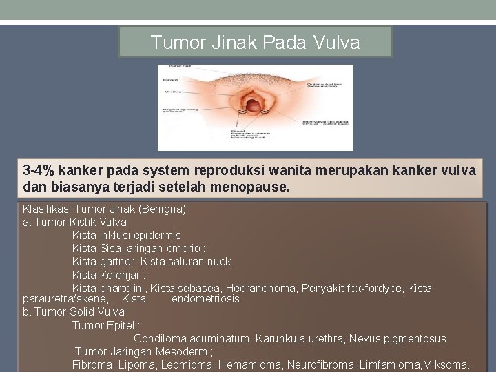Tumor Jinak Pada Vulva 3 -4% kanker pada system reproduksi wanita merupakan kanker vulva