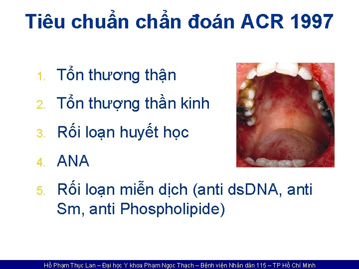 Tiêu chuẩn chẩn đoán ACR 1997 1. Tổn thương thận 2. Tổn thượng thần