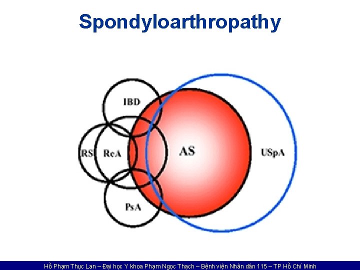 Spondyloarthropathy Hồ Phạm Thục Lan – Đại học Y khoa Phạm Ngọc Thạch –