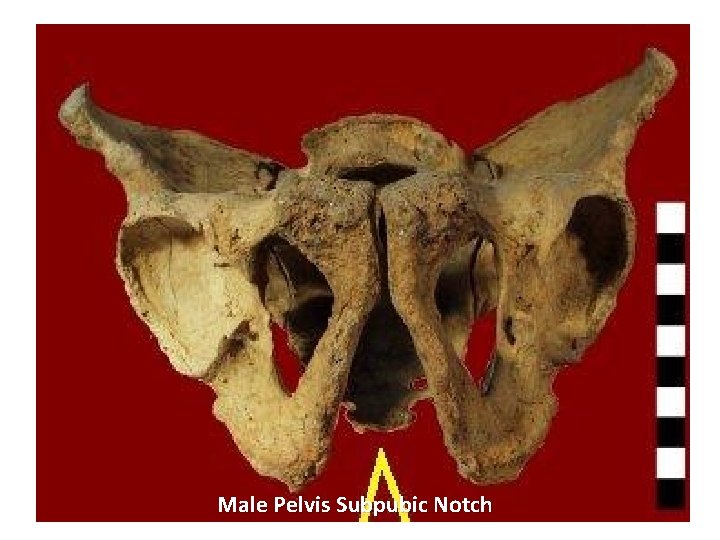 Male Pelvis Subpubic Notch 