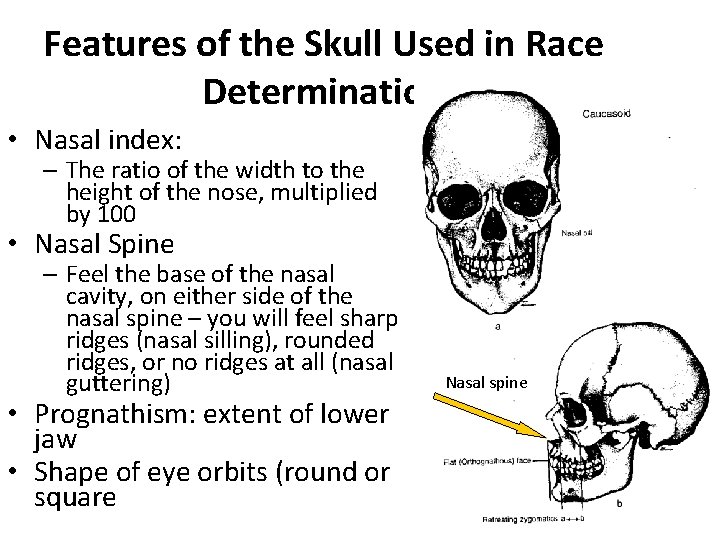 Features of the Skull Used in Race Determination • Nasal index: – The ratio