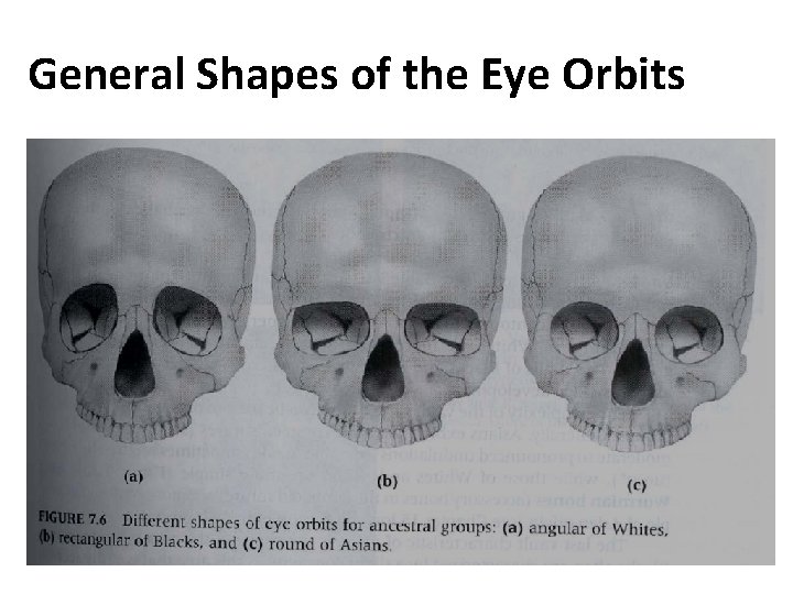 General Shapes of the Eye Orbits 