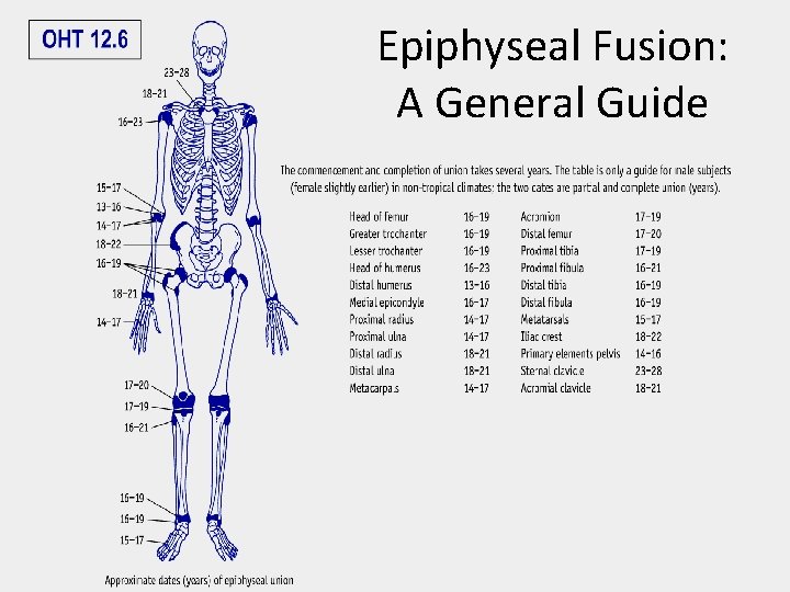 Epiphyseal Fusion: A General Guide 