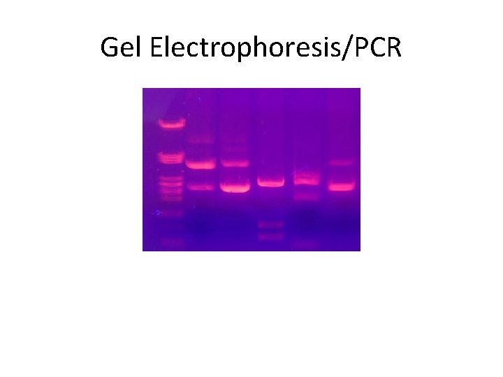 Gel Electrophoresis/PCR 