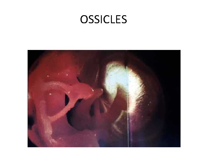 OSSICLES 