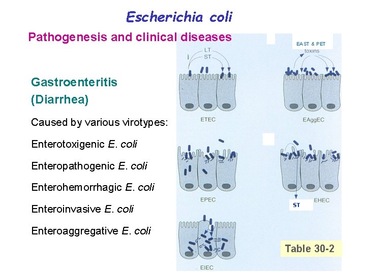 Escherichia coli Pathogenesis and clinical diseases EAST & PET Gastroenteritis (Diarrhea) Caused by various