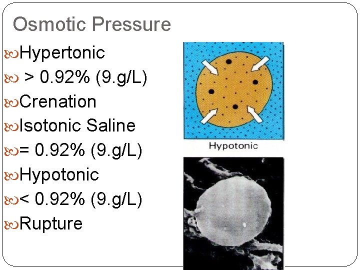 Osmotic Pressure Hypertonic > 0. 92% (9. g/L) Crenation Isotonic Saline = 0. 92%