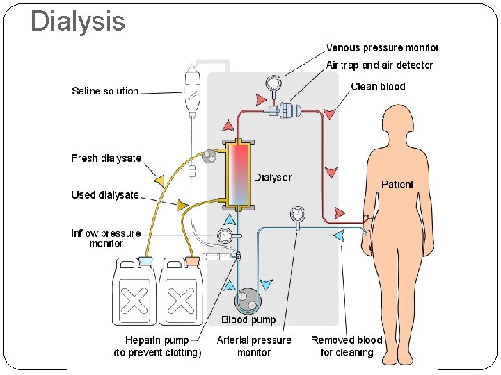 Dialysis 