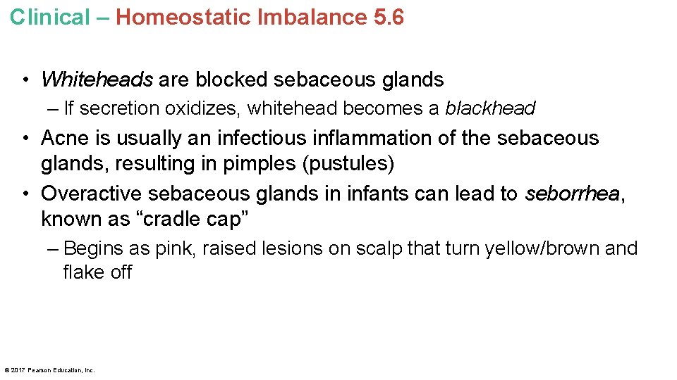 Clinical – Homeostatic Imbalance 5. 6 • Whiteheads are blocked sebaceous glands – If