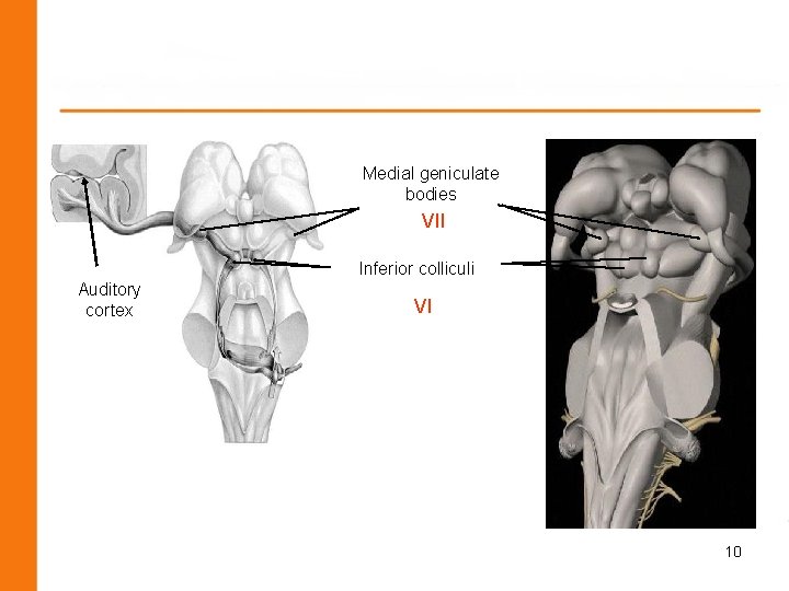 Medial geniculate bodies VII Inferior colliculi Auditory cortex VI 10 