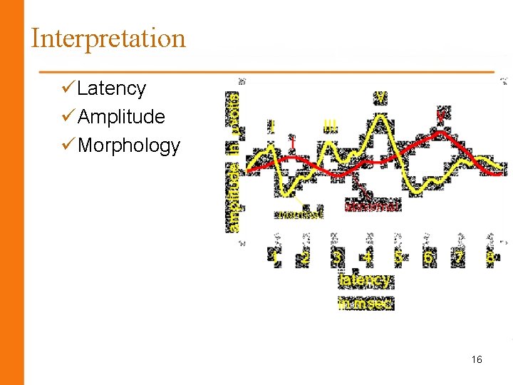 Interpretation üLatency üAmplitude üMorphology 16 