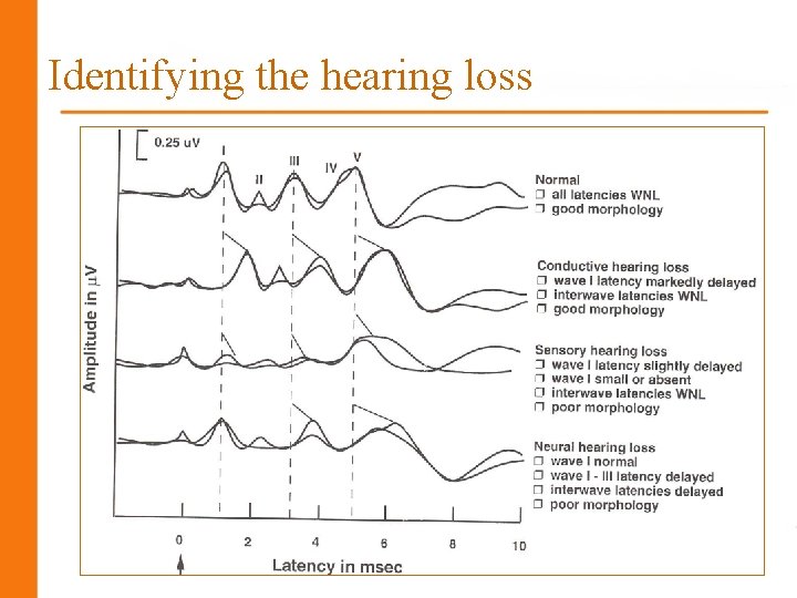 Identifying the hearing loss 28 