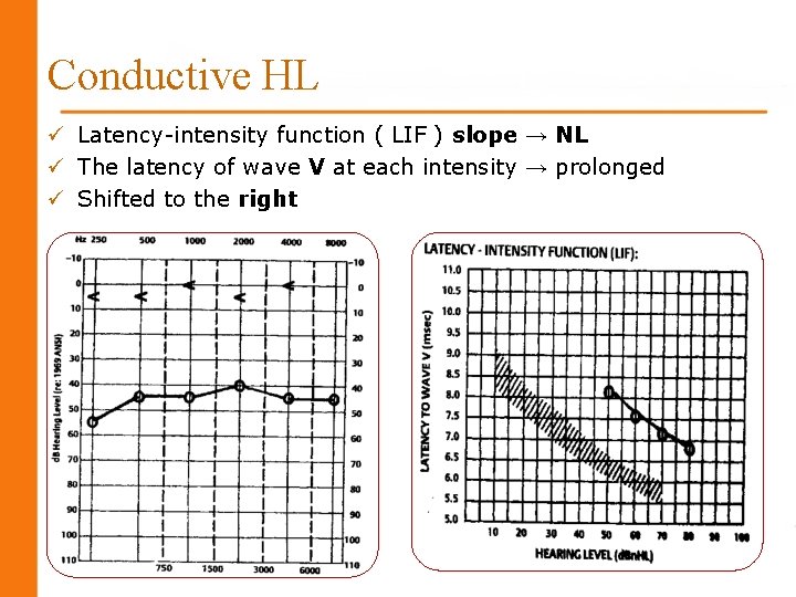 Conductive HL ü Latency-intensity function ( LIF ) slope → NL ü The latency