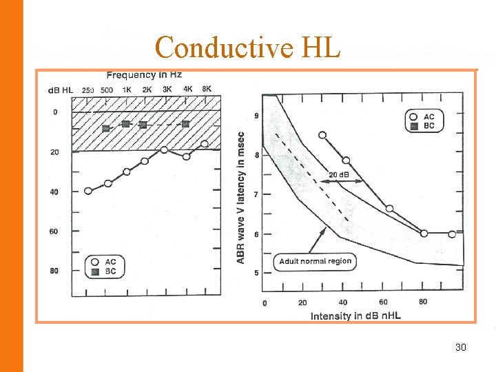 Conductive HL 30 