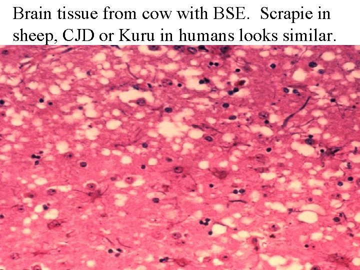 Brain tissue from cow with BSE. Scrapie in sheep, CJD or Kuru in humans