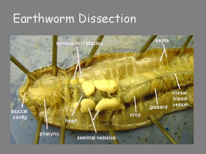 Earthworm Dissection 