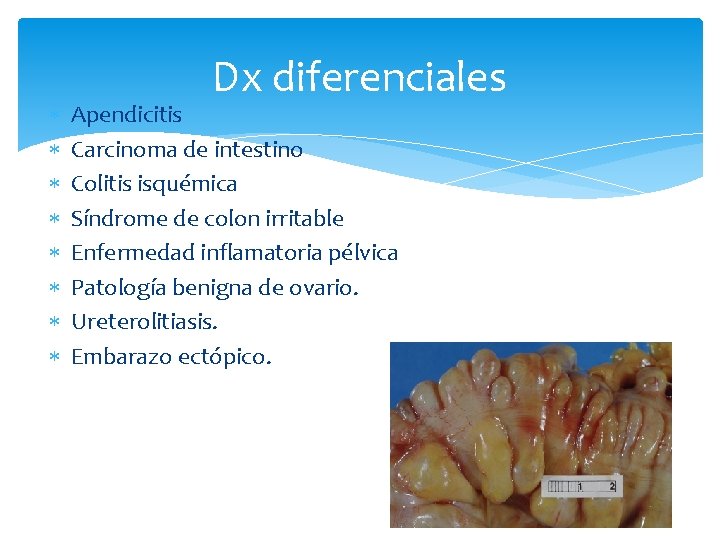  Dx diferenciales Apendicitis Carcinoma de intestino Colitis isquémica Síndrome de colon irritable Enfermedad