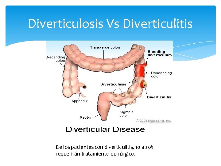Diverticulosis Vs Diverticulitis De los pacientes con diverticulitis, 10 a 20% requerirán tratamiento quirúrgico.