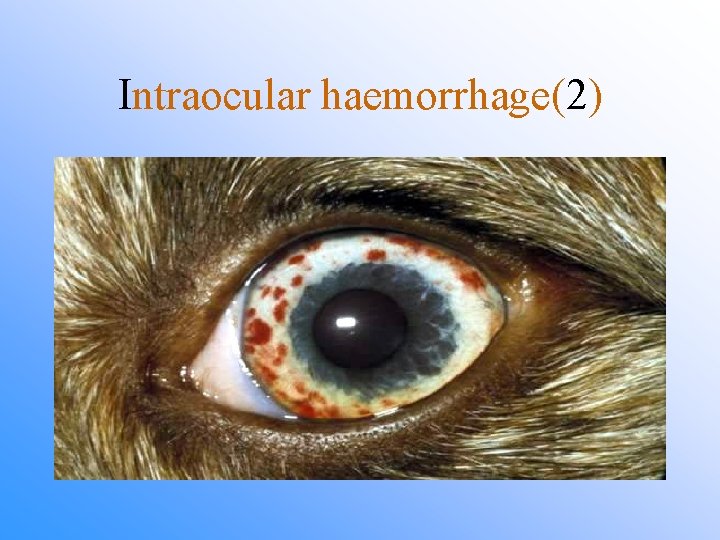 Intraocular haemorrhage(2) 
