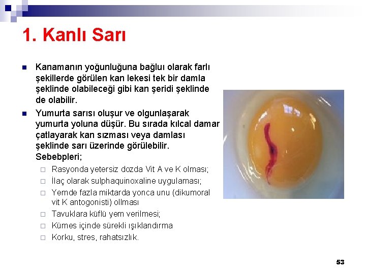 1. Kanlı Sarı n n Kanamanın yoğunluğuna bağluı olarak farlı şekillerde görülen kan lekesi