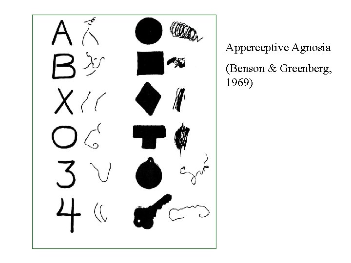 Apperceptive Agnosia (Benson & Greenberg, 1969) 
