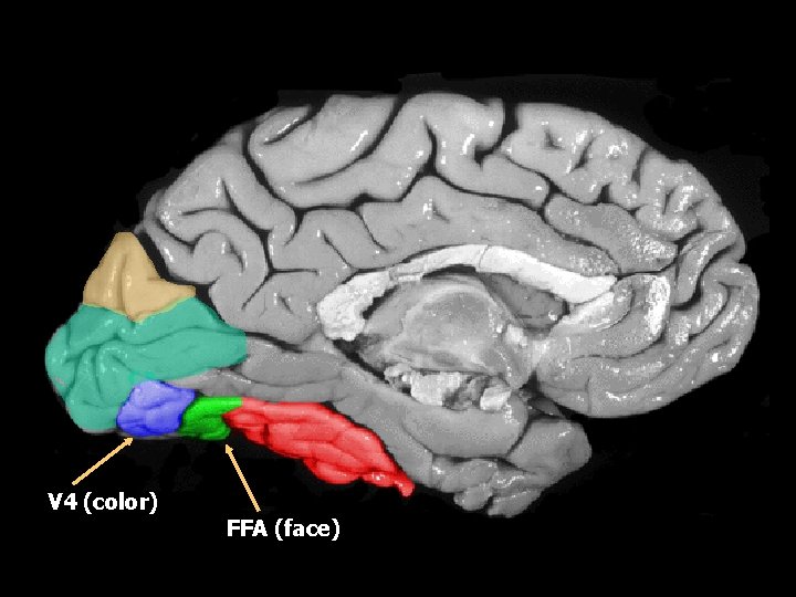 V 4 (color) FFA (face) 