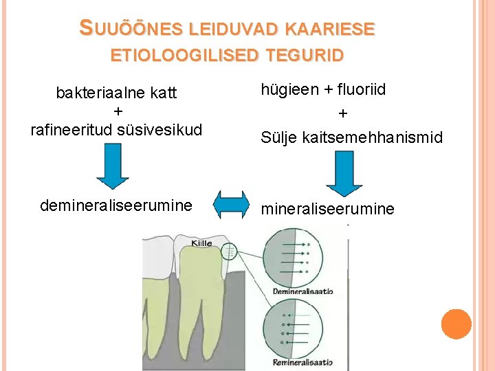 SUUÕÕNES LEIDUVAD KAARIESE ETIOLOOGILISED TEGURID bakteriaalne katt + rafineeritud süsivesikud demineraliseerumine hügieen + fluoriid