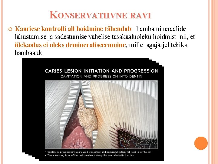 KONSERVATIIVNE RAVI Kaariese kontrolli all hoidmine tähendab hambamineraalide lahustumise ja sadestumise vahelise tasakaaluoleku hoidmist