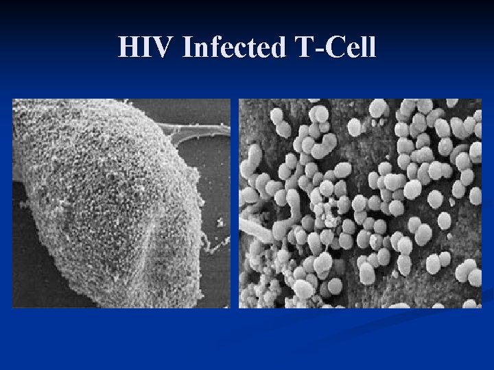 HIV Infected T-Cell 