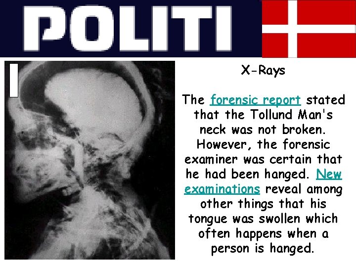 X-Rays The forensic report stated that the Tollund Man's neck was not broken. However,