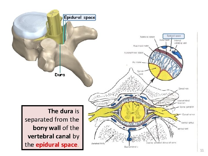The dura is separated from the bony wall of the vertebral canal by the