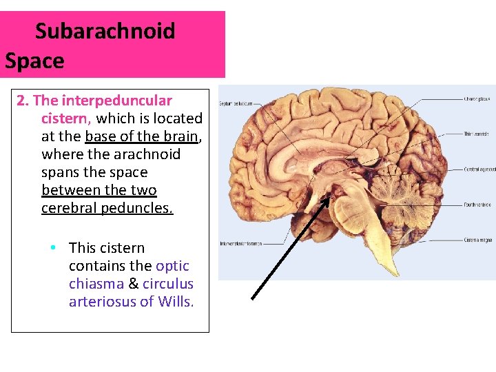 Subarachnoid Space 2. The interpeduncular cistern, which is located at the base of the