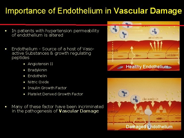 Importance of Endothelium in Vascular Damage § In patients with hypertension permeability of endothelium
