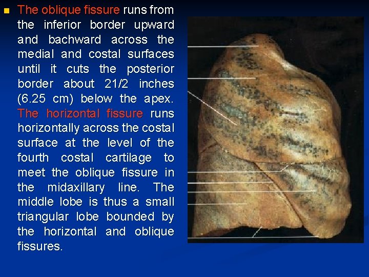 n The oblique fissure runs from the inferior border upward and bachward across the