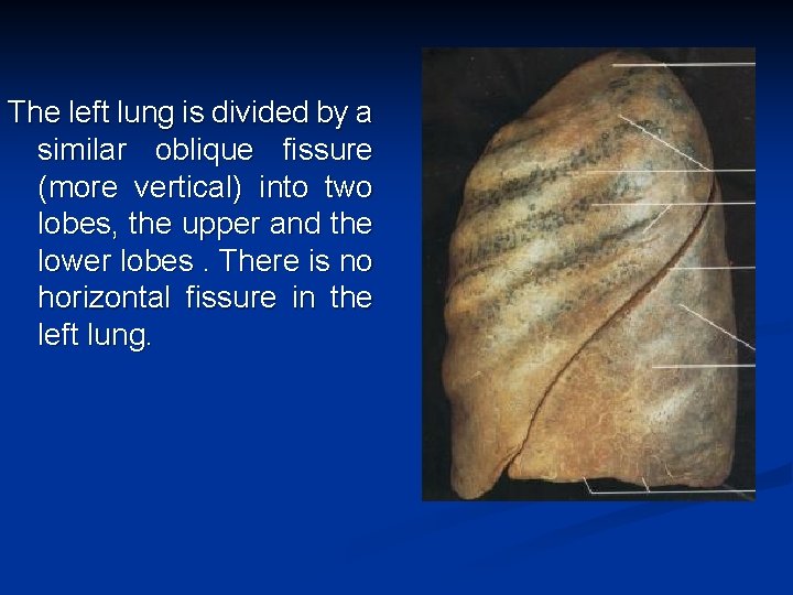 The left lung is divided by a similar oblique fissure (more vertical) into two