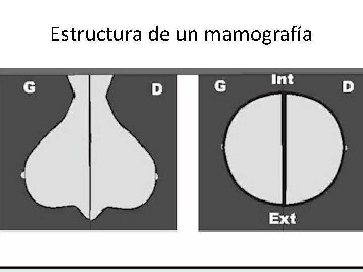 Estructura de un mamografía 