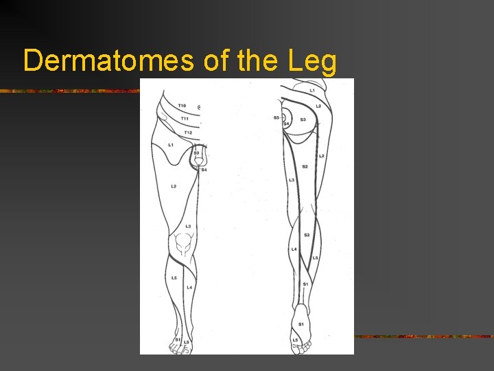 Dermatomes of the Leg  Dermatomes of the Leg