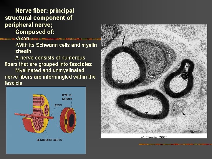 Nerve fiber: principal structural component of peripheral nerve; Composed of: • Axon • With Nerve fiber: principal structural component of peripheral nerve; Composed of: • Axon • With