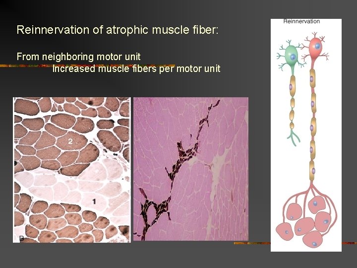 Reinnervation of atrophic muscle fiber: From neighboring motor unit Increased muscle fibers per motor Reinnervation of atrophic muscle fiber: From neighboring motor unit Increased muscle fibers per motor