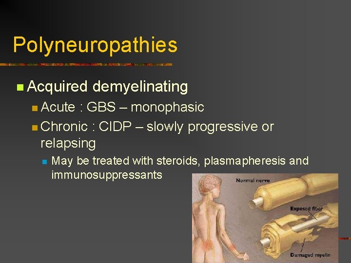 Polyneuropathies n Acquired demyelinating n Acute : GBS – monophasic n Chronic : CIDP Polyneuropathies n Acquired demyelinating n Acute : GBS – monophasic n Chronic : CIDP