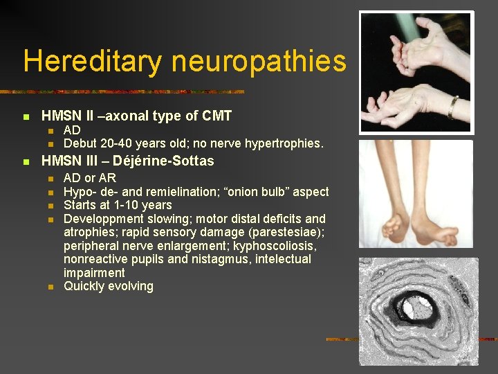 Hereditary neuropathies n HMSN II –axonal type of CMT n n n AD Debut Hereditary neuropathies n HMSN II –axonal type of CMT n n n AD Debut