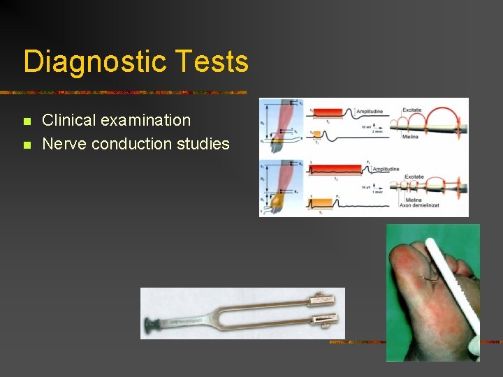 Diagnostic Tests n n Clinical examination Nerve conduction studies  Diagnostic Tests n n Clinical examination Nerve conduction studies