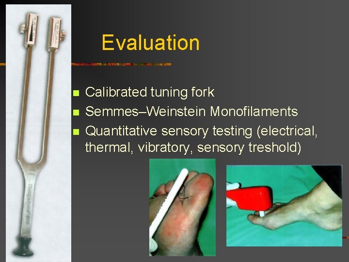 Evaluation n Calibrated tuning fork Semmes–Weinstein Monofilaments Quantitative sensory testing (electrical, thermal, vibratory, sensory Evaluation n Calibrated tuning fork Semmes–Weinstein Monofilaments Quantitative sensory testing (electrical, thermal, vibratory, sensory