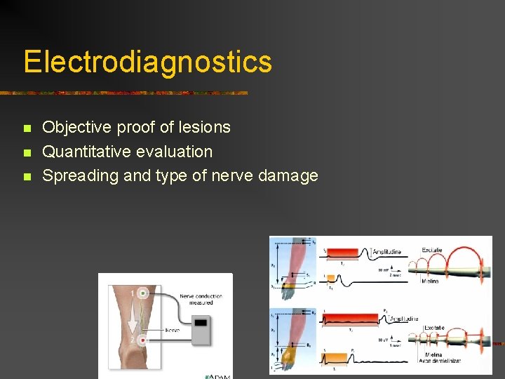 Electrodiagnostics n n n Objective proof of lesions Quantitative evaluation Spreading and type of Electrodiagnostics n n n Objective proof of lesions Quantitative evaluation Spreading and type of