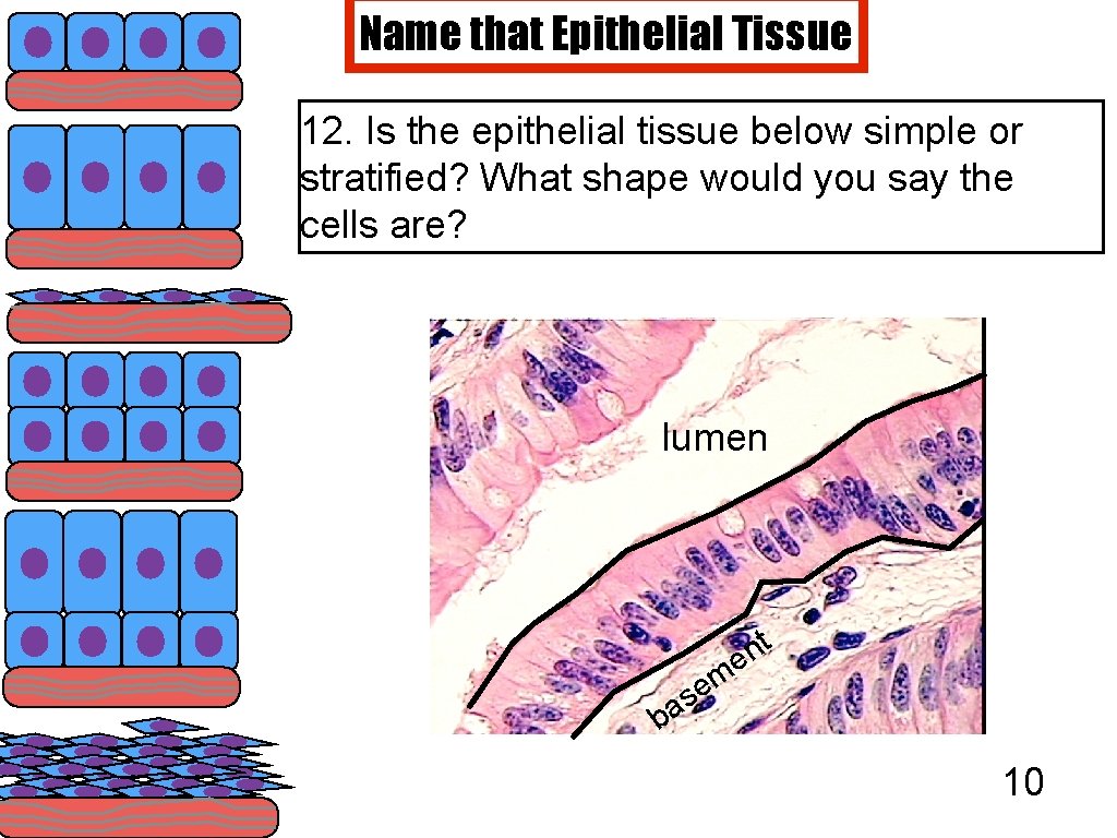 Name that Epithelial Tissue 12. Is the epithelial tissue below simple or stratified? What