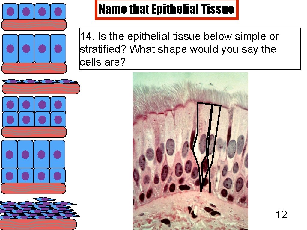 Name that Epithelial Tissue 14. Is the epithelial tissue below simple or stratified? What