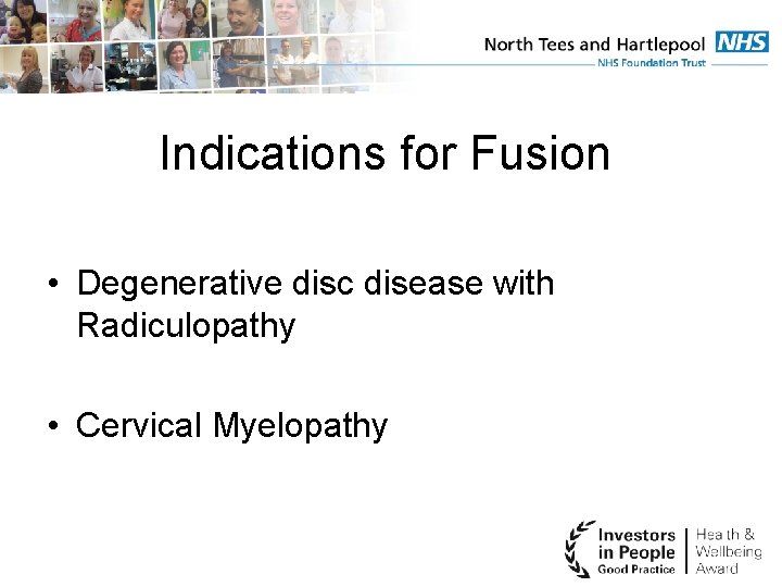 Indications for Fusion • Degenerative disc disease with Radiculopathy • Cervical Myelopathy 